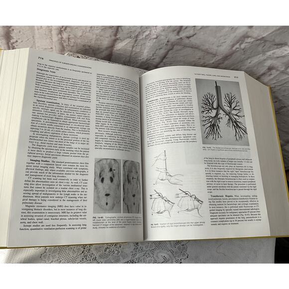 1999 Principles Of Surgery 7th Edition Hardback VG - Picture 7 of 8